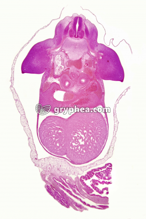 Embryon de Porc de 10mm CT x4 - gryphea.org